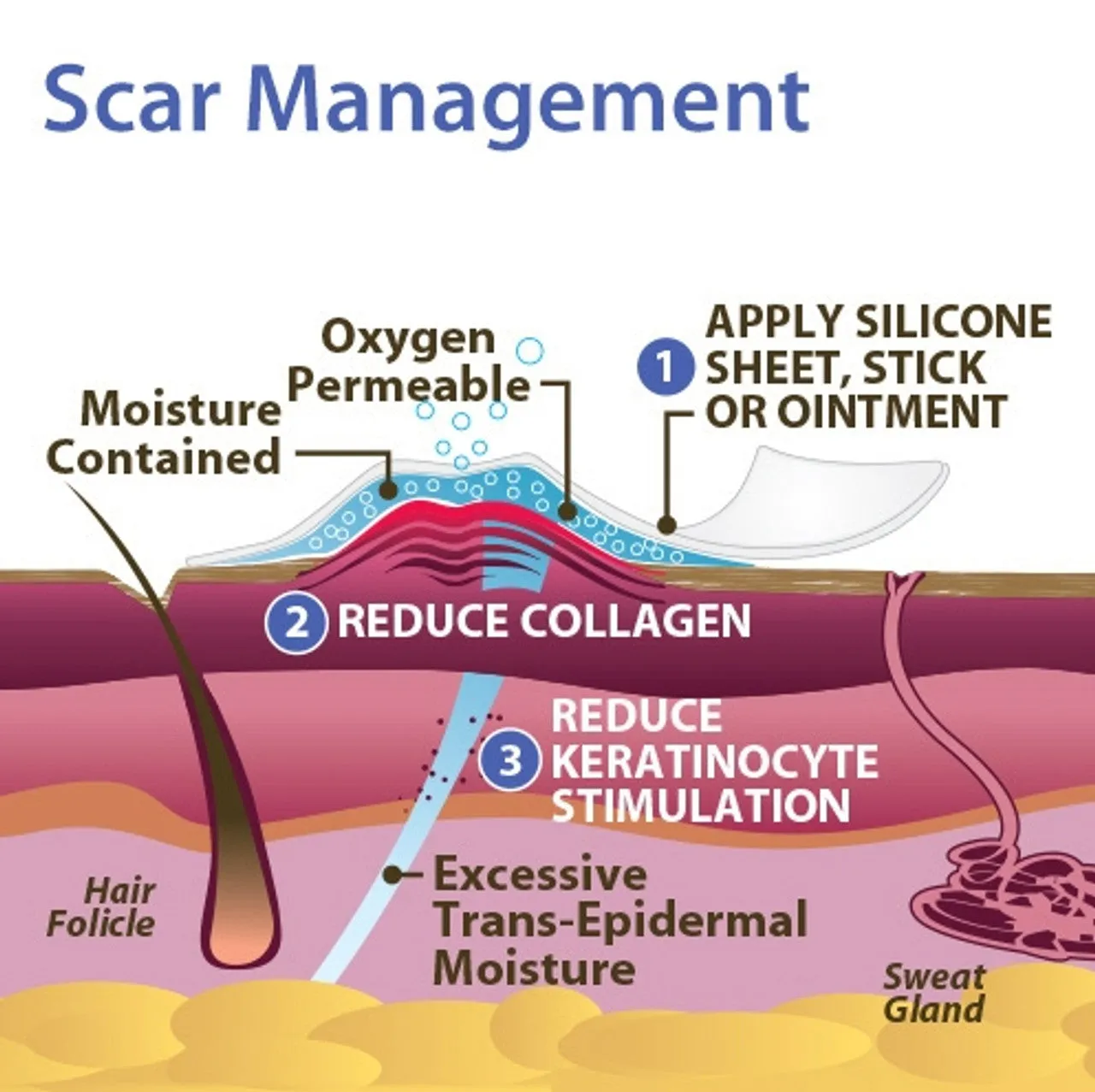 Epi-Derm Gel Mastopexy Sheet